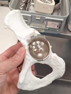 Pelvis model in clinical environment