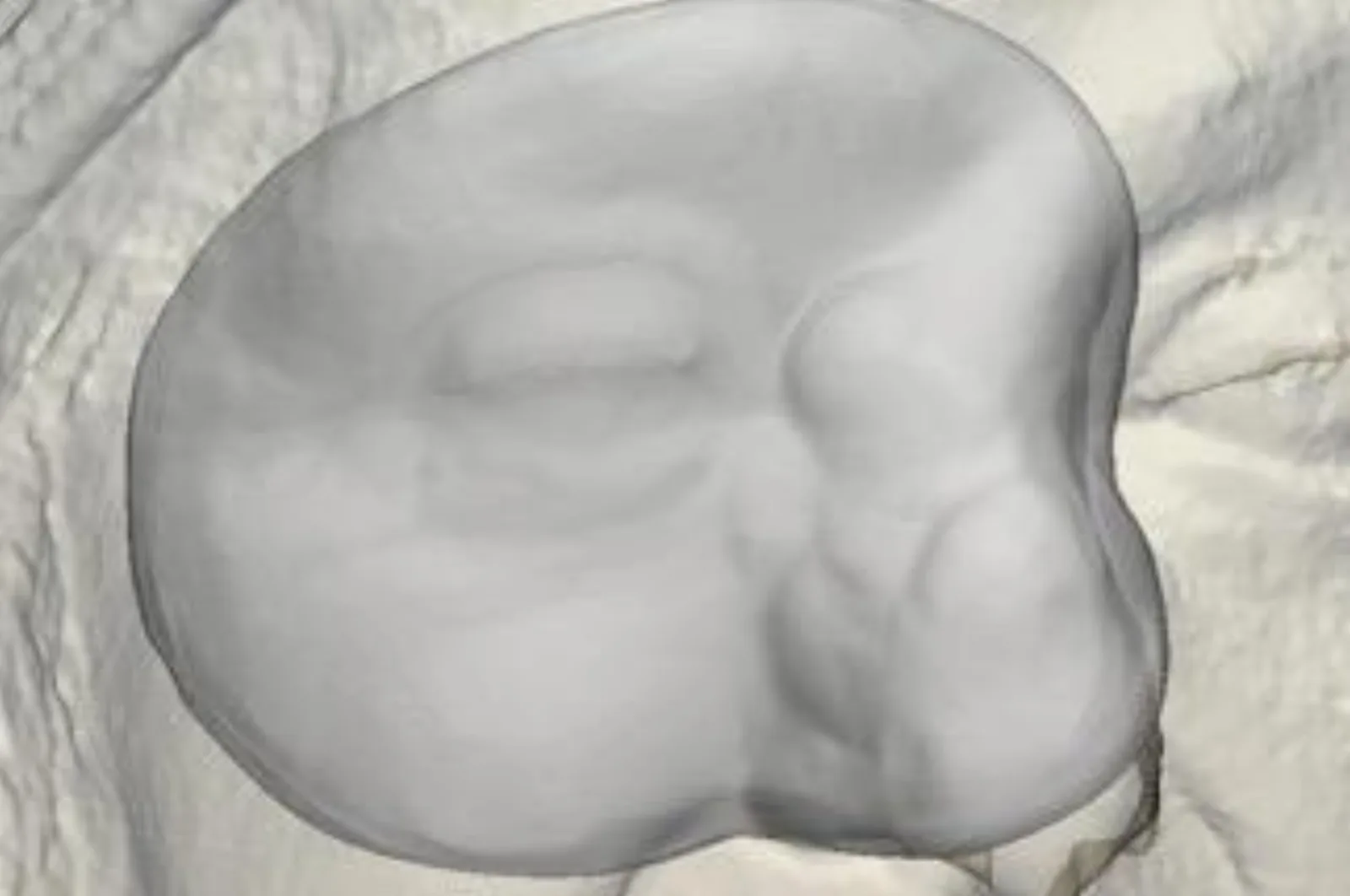 White 3D printed facial bolus