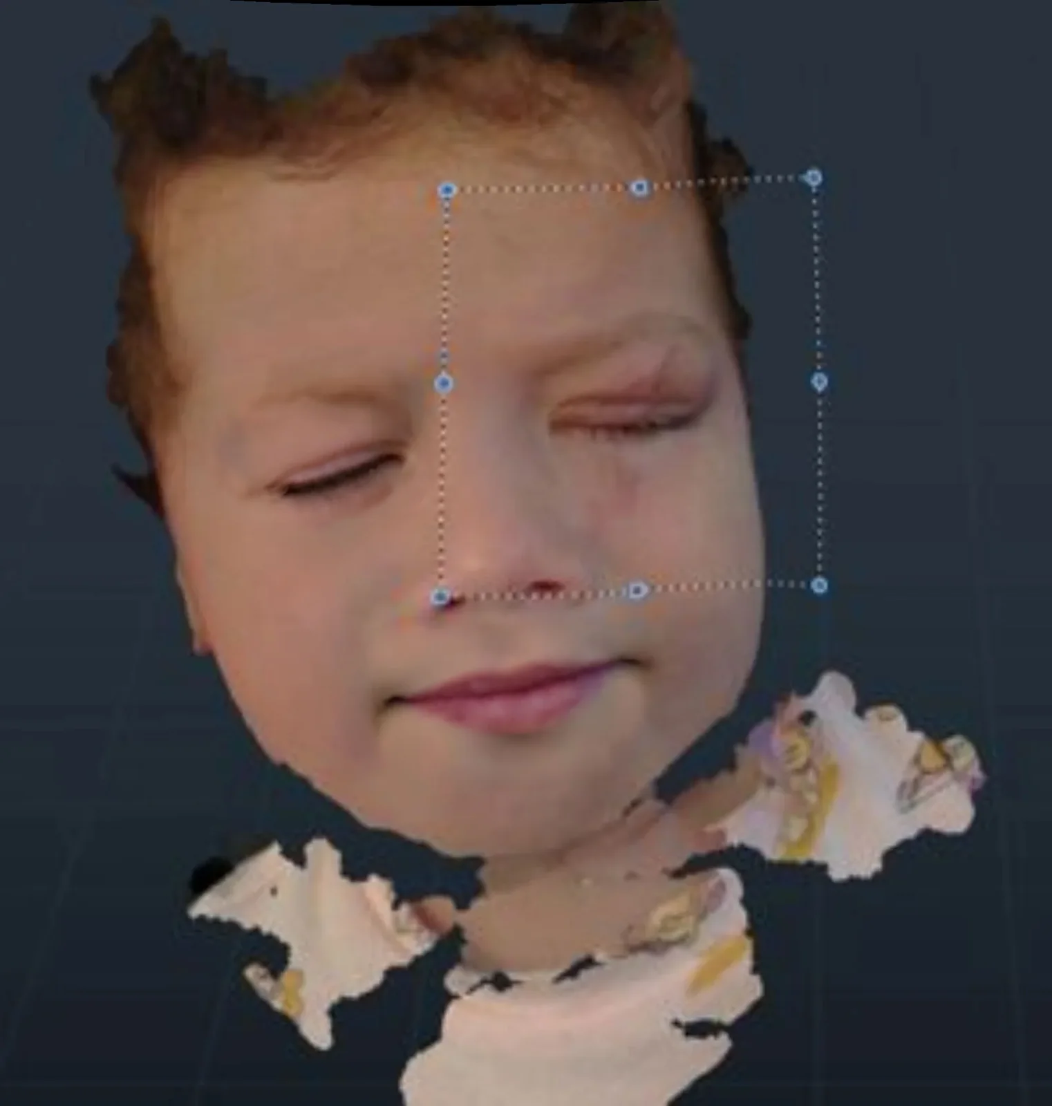 3D scan of child's face in mesh editor