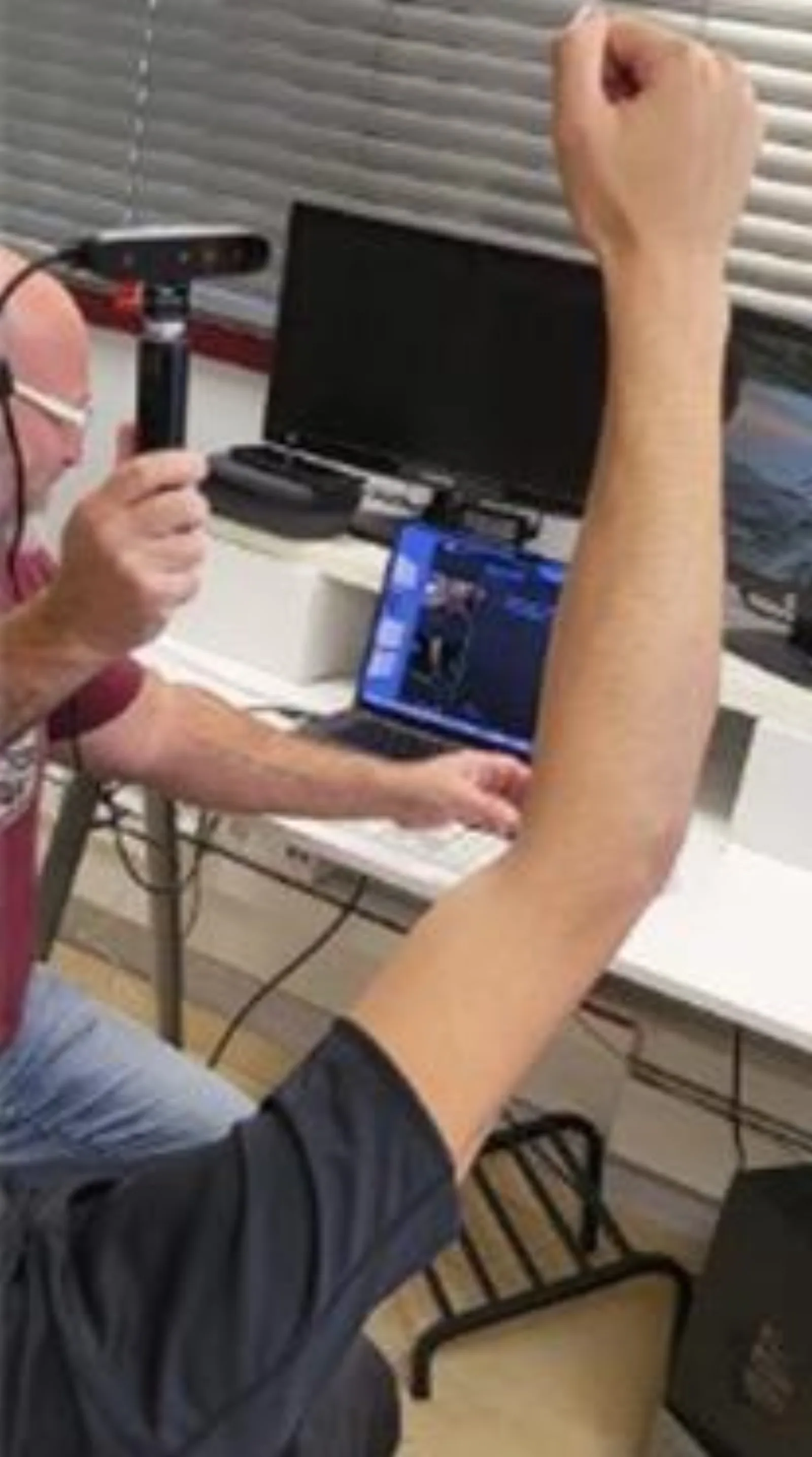 3D scanning arm for splint design